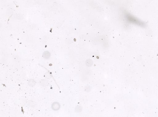 Diphyllobothrium erinacei