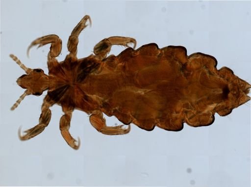Pediculus humanus