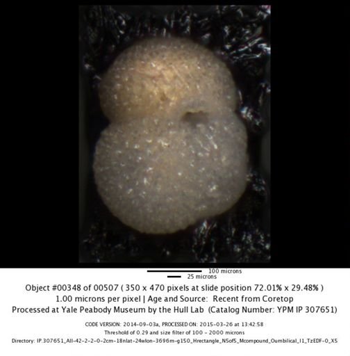 Globigerinoides sacculifer