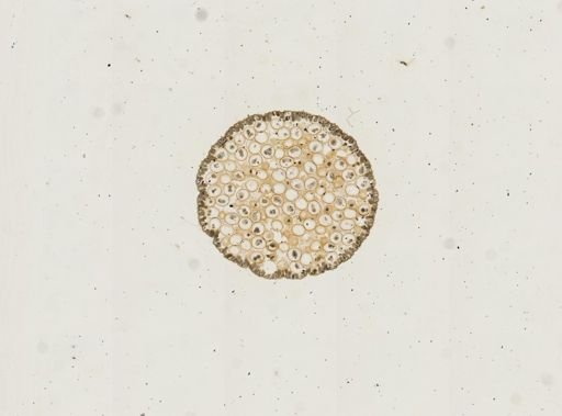 Ascaris