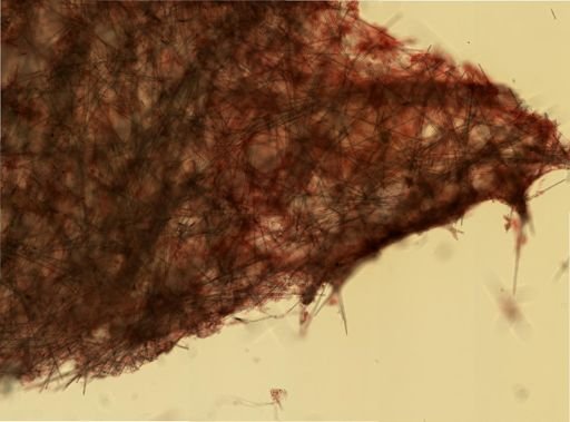 Halichondria genitrix?