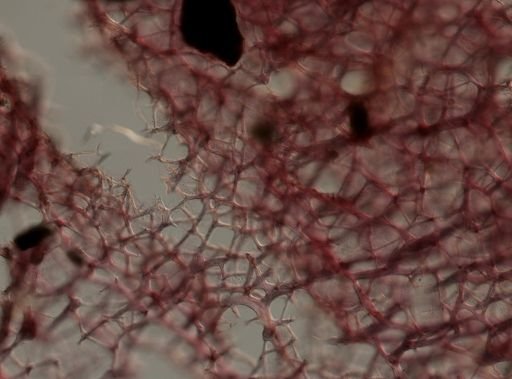 Callyspongia vaginalis