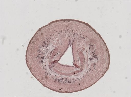 Erpobdella punctata