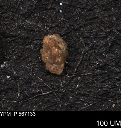Verneuilina canadensis