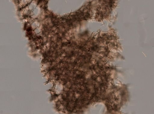 Keratosa