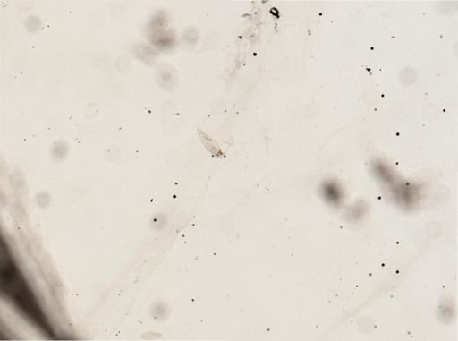Paramecium