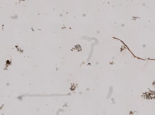 Haliclona