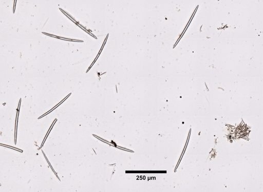 Spongilla lacustris