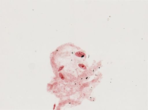 Paramecium calkinsi