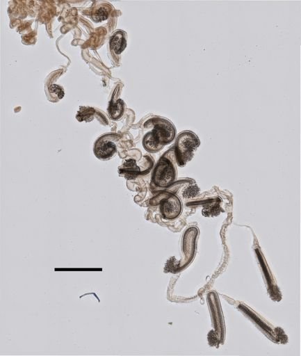 Stephanophyes superba