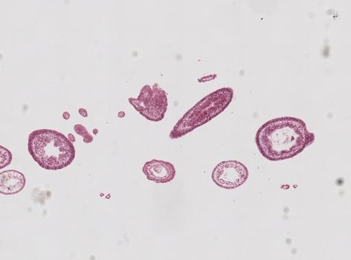 Hydra