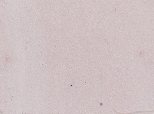 Trypanosoma equinum