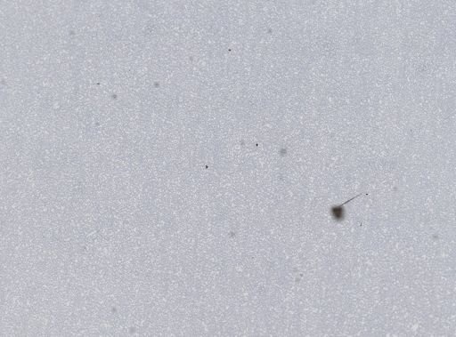 Plasmodium vivax