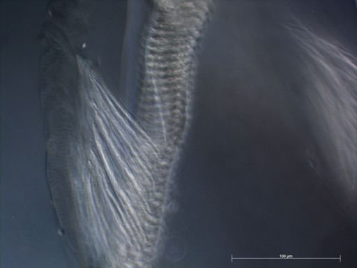 Abylopsis tetragona