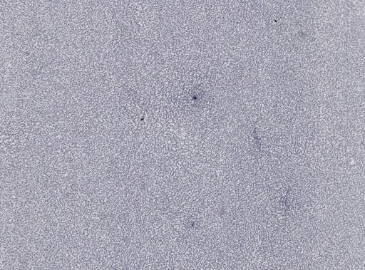 Plasmodium falciparum