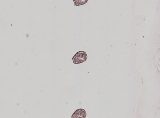 Plagiostomum whitmani