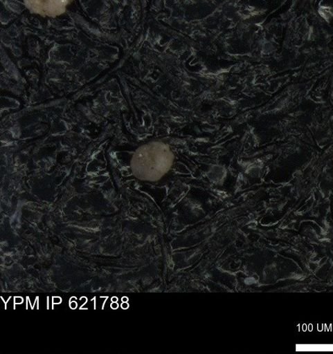 undet. Foraminiferida