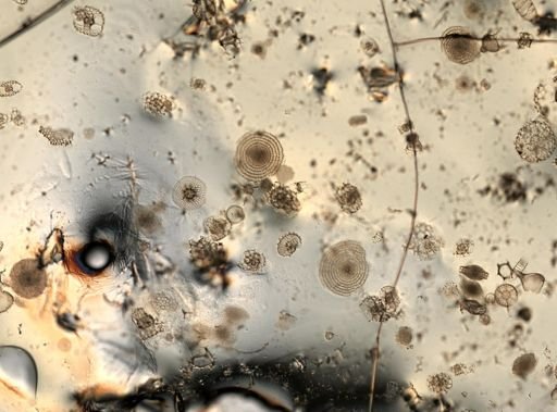 Foraminifera