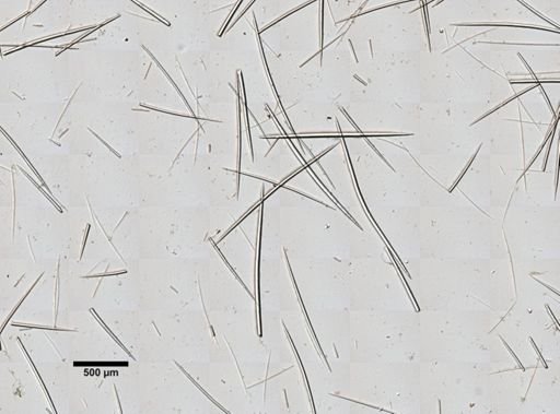 Asteropus ketostea