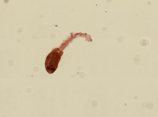 Digenea