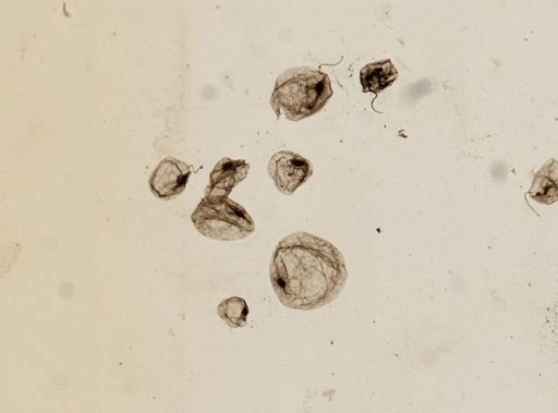 Noctiluca