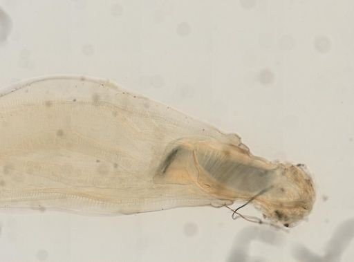Echinorhynchus