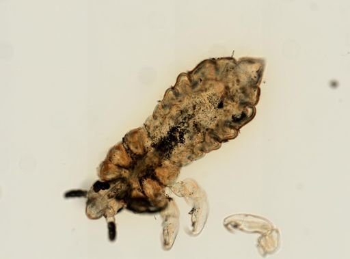 Pediculus humanus