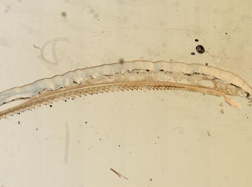 Acrididae