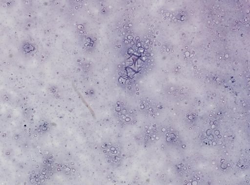 Leishmania donovani