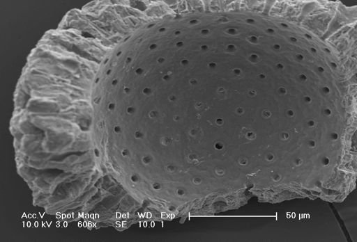 Globigerinoides sacculifer