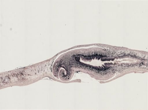 Turbellaria