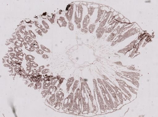 Ceratoporella nicholsoni