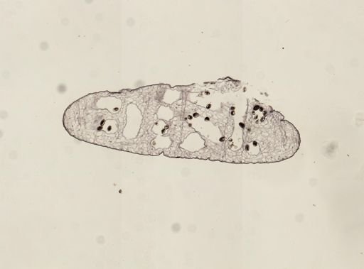 Dicrocoelium dendriticum