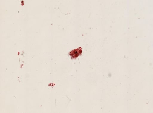 Acanthometra