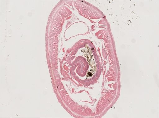 Oligochaeta