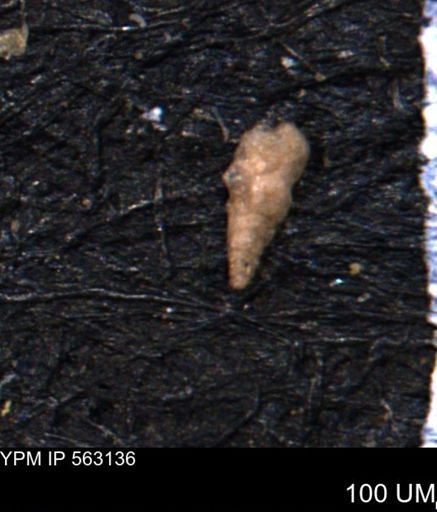 Verneuilina canadensis