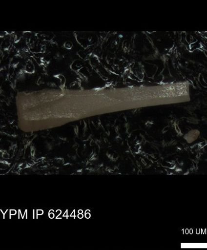 undet. Echinoidea