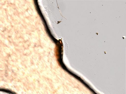 Trichocerca