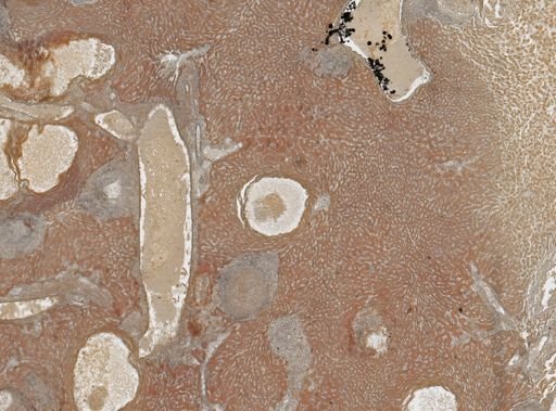 Taenia taeniaeformis