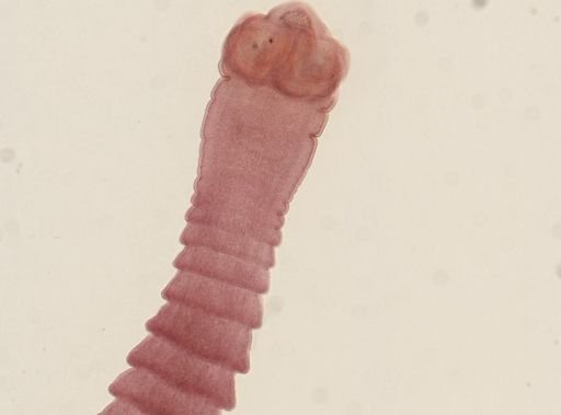 Dipylidium caninum