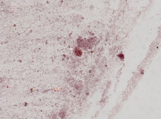 Troglodytella