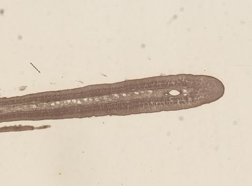 Taenia taeniaeformis