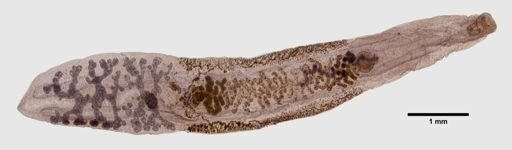 Clonorchis sinensis