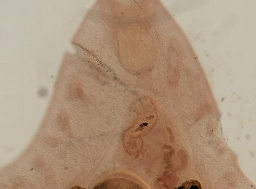 Fasciola hepatica