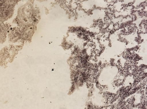 Filaria