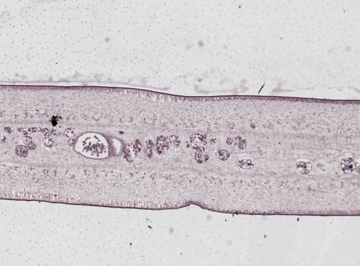 Taenia saginata