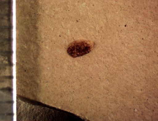 undet. Coleoptera