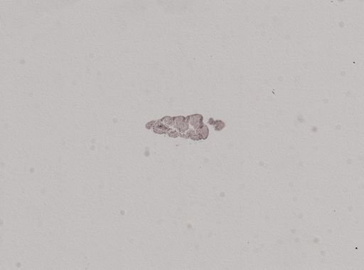 Crepidula plana