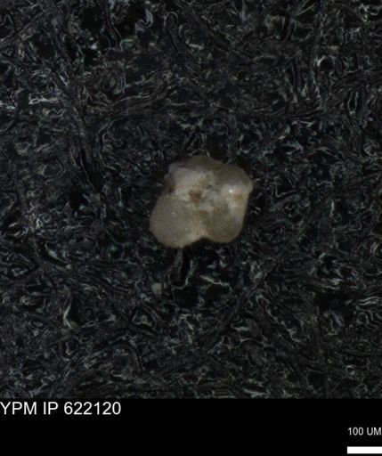 undet. Rugoglobigerinidae