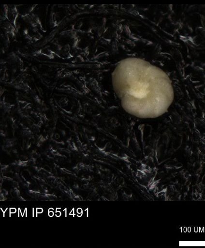 undet. Foraminiferida